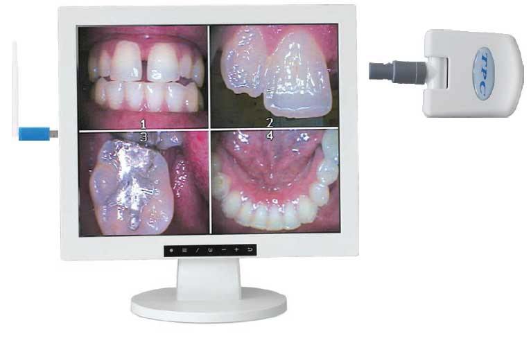TPC Dental AIC2IN1W 17" Flat Screen Monitor Multi-Media w/AIC5855A Intra-oral Camera Pkg