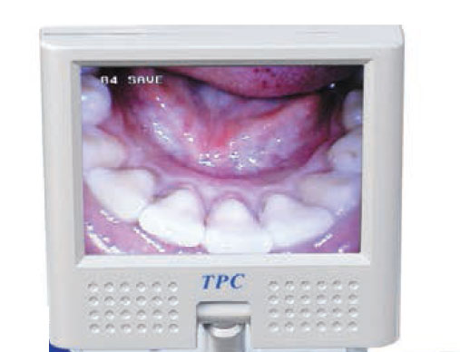 TPC Dental AIC5111 Camera Mounted LCD Display 2.5"