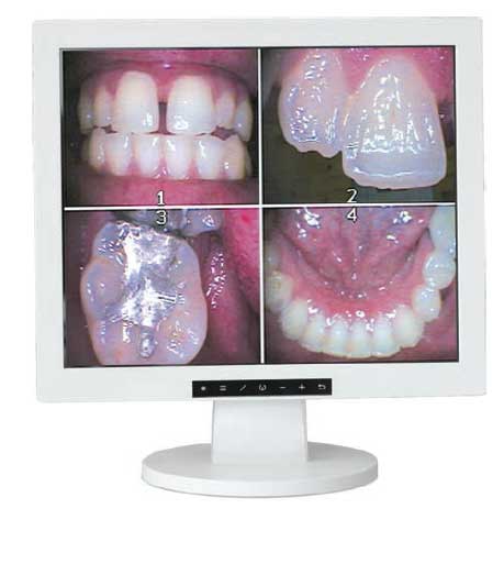 TPC Dental MO17 Mirage Flat Screen Monitor
